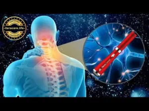 como tratar el dolor de cabeza con iteracare